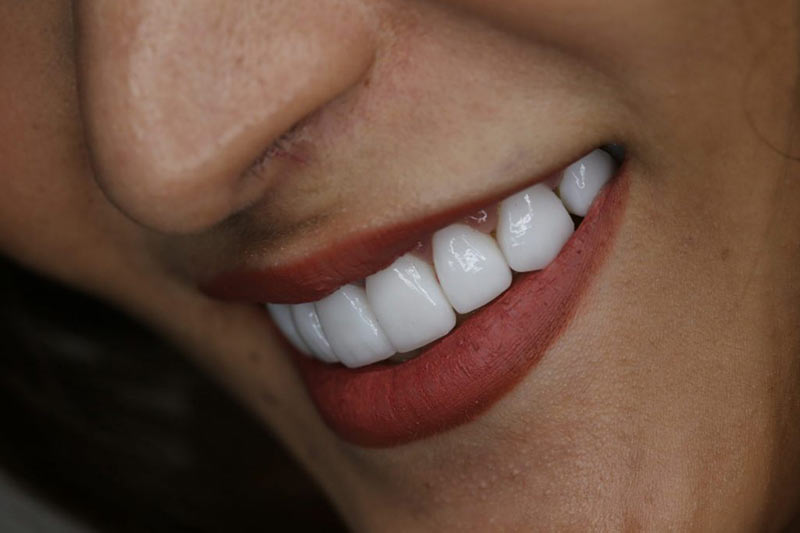 Are veneers the right dental treatment for you blog cover