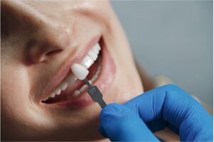 Dental crowns procedure | Apostol Dental Cosmetic Center
