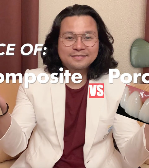 Direct Composite Veneers VS Emax Porcelain Veneers